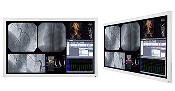 conozca-el-monitor-de-alta-definicion-de-55-para-cirugia-s551