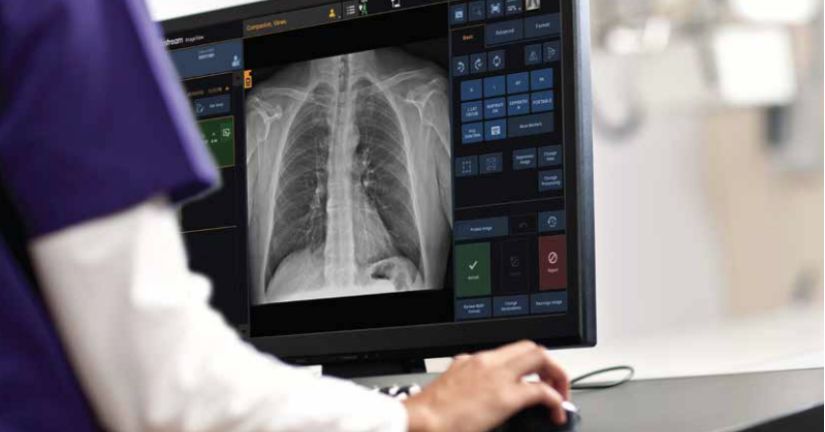 drx-lc-detector-examenes-de-larga-duracion-mas-rapidos