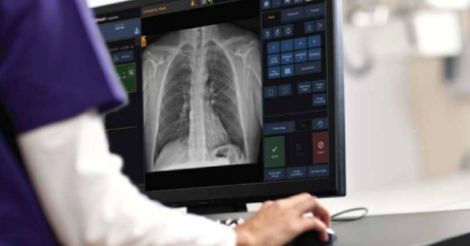 drx-lc-detector-examenes-de-larga-duracion-mas-rapidos