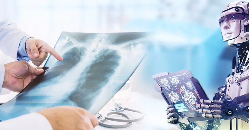 ia-predice-riesgo-de-enfermedades-cardiacas-utilizando-una-sola-radiografia