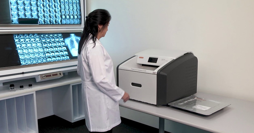 imagenes-de-mamografia-excepcionales-para-diagnosticos-de-alta-calidad