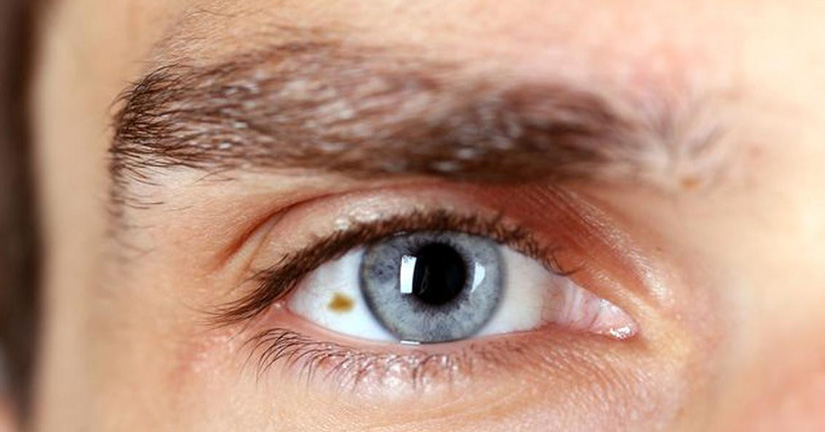 los-sintomas-que-alertan-de-un-melanoma-ocular-el-tipo-de-cancer-de-ojo-mas-frecuente