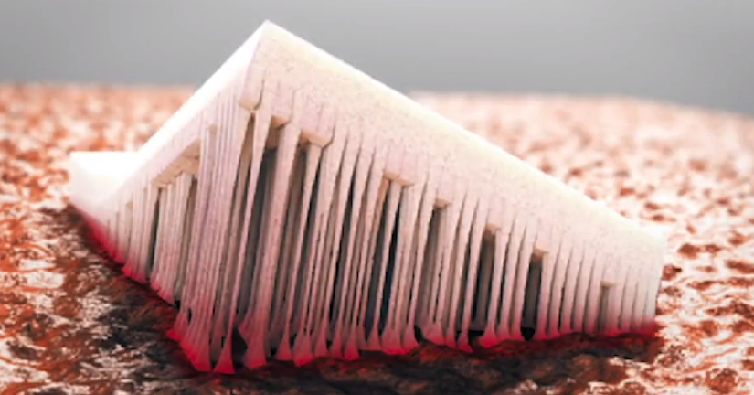 tenatac-es-un-novedoso-hemostatico-quirurgico