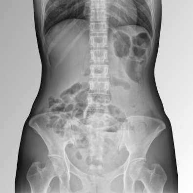 detector_de_foco_35c_4