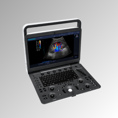 ecgrafo_porttil_e2_pro_v